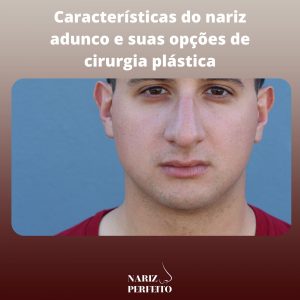 Características do nariz adunco e suas opções de cirurgia plástica