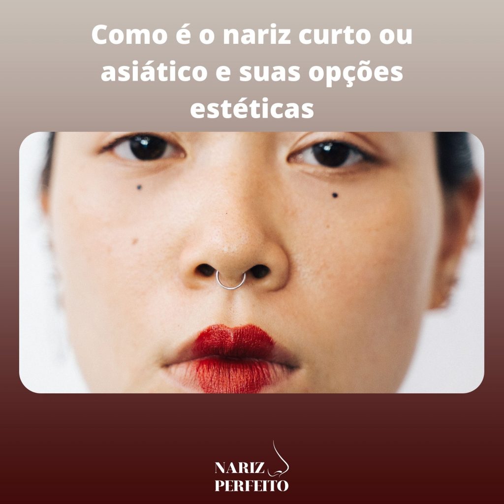 Como é o nariz curto ou asiático e suas opções estéticas