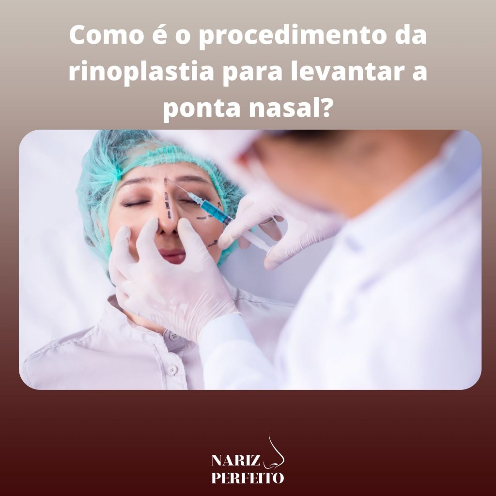 Como é o procedimento da rinoplastia para levantar a ponta nasal?
