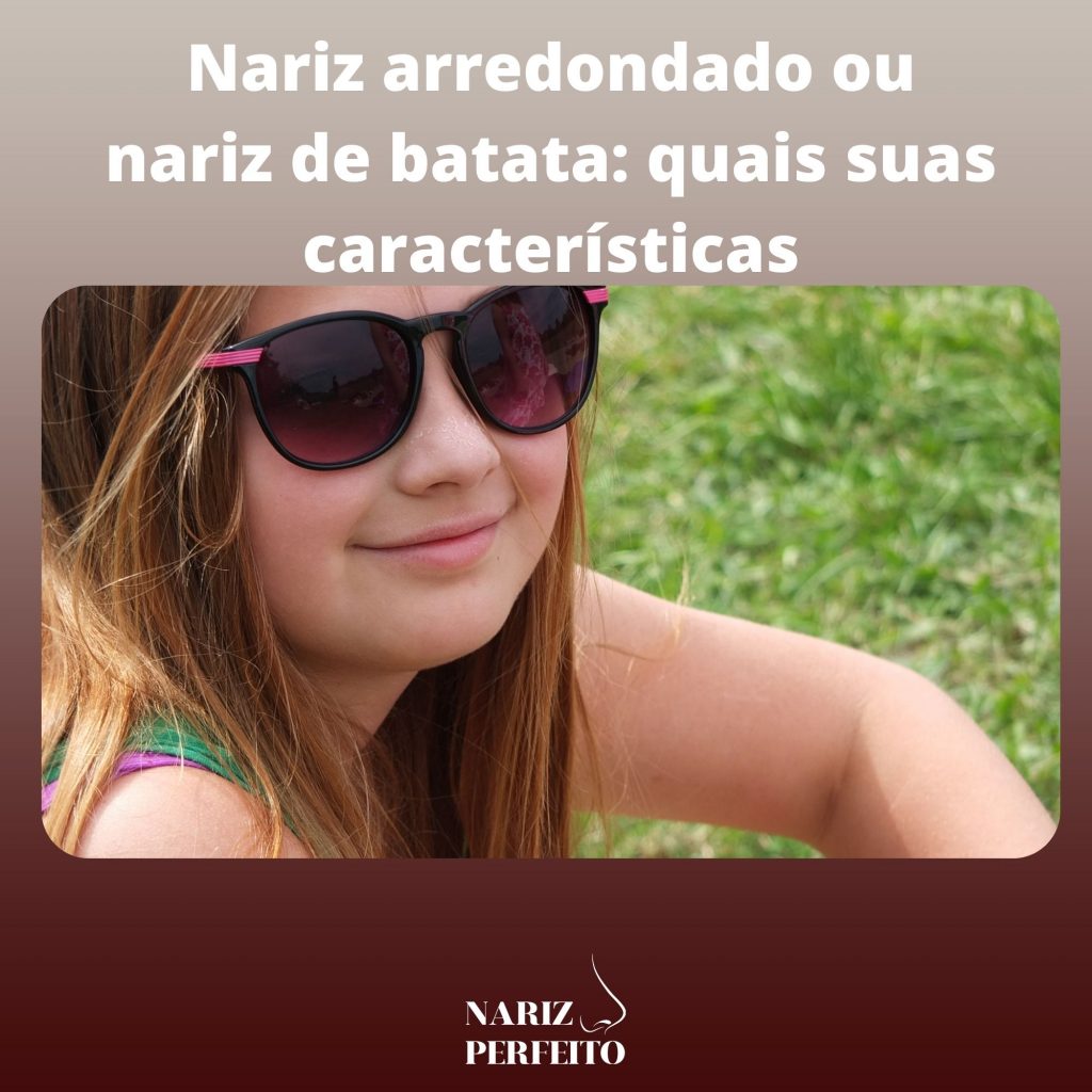 Nariz arredondado ou nariz de batata: quais suas características