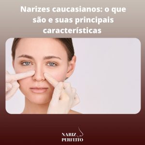 Narizes caucasianos: o que são e suas principais características 