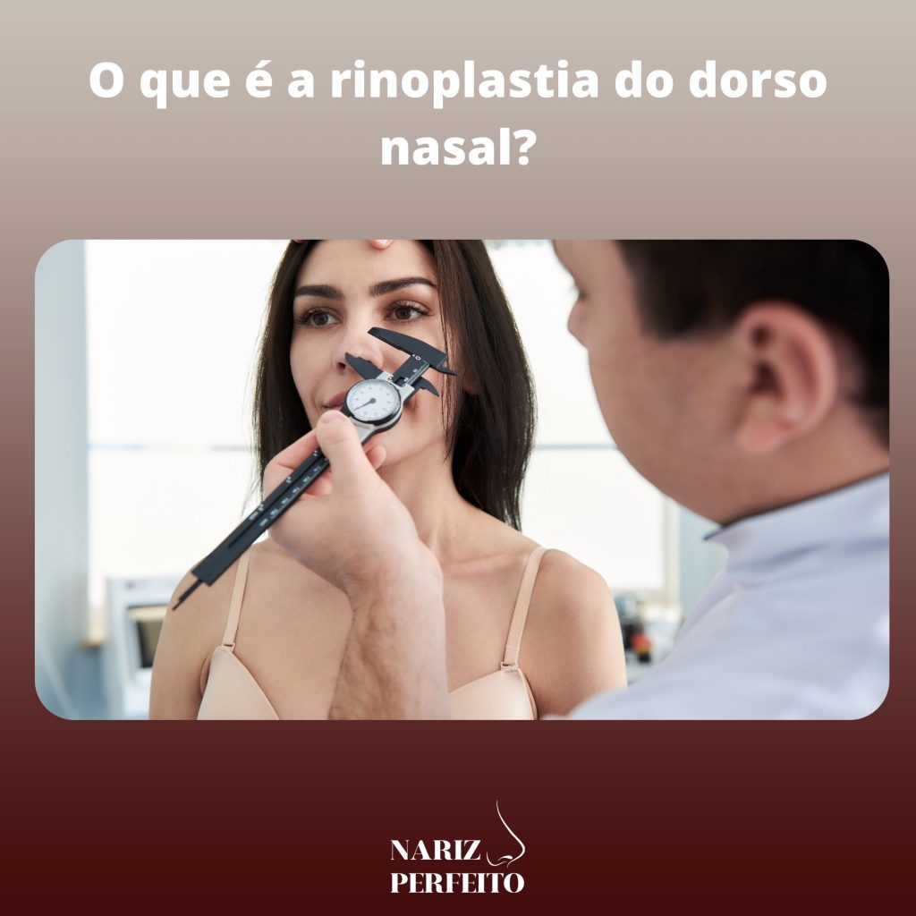 O que é a rinoplastia do dorso nasal?