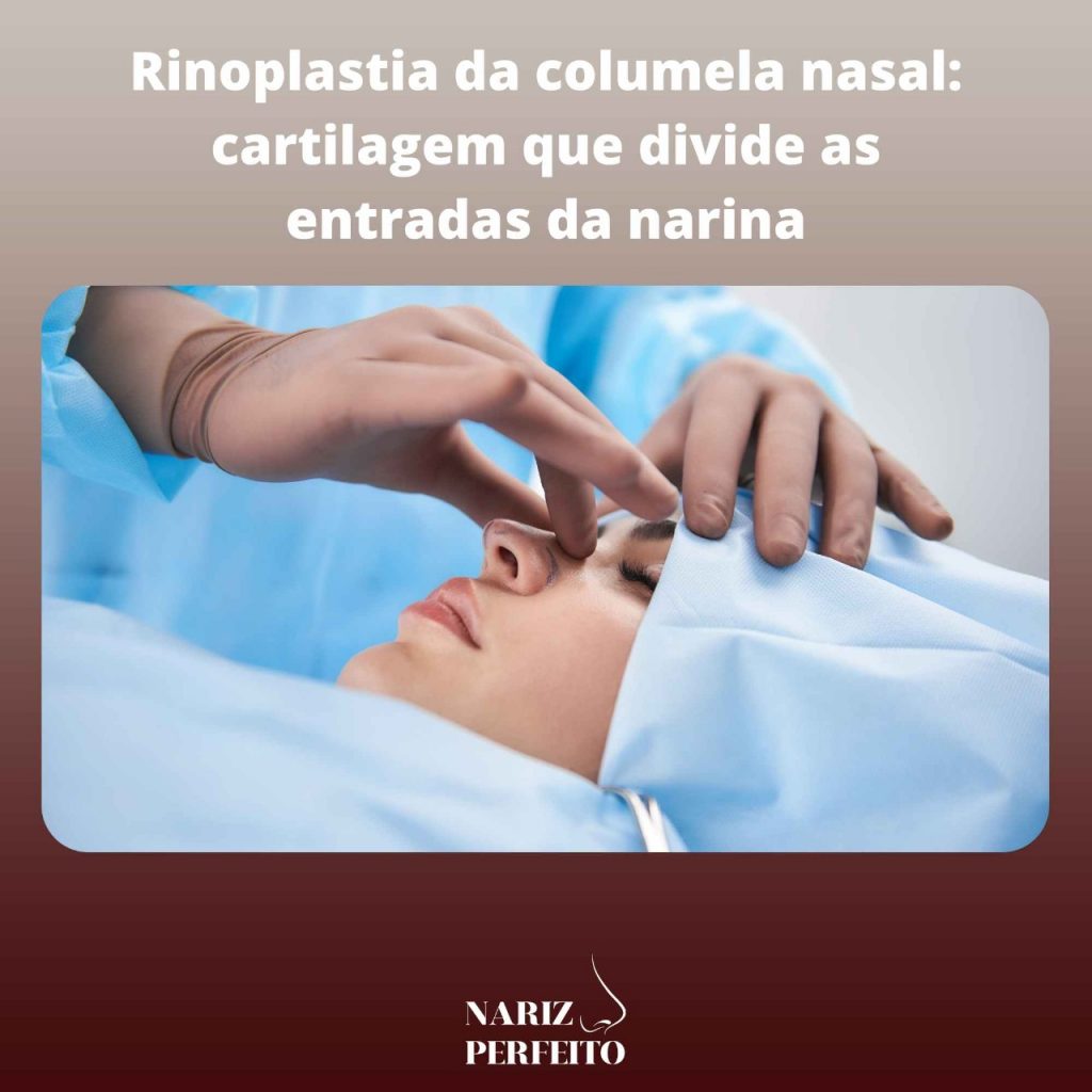 Rinoplastia da columela nasal: cartilagem que divide as entradas da narina