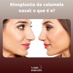 Rinoplastia da columela nasal: o que é e?