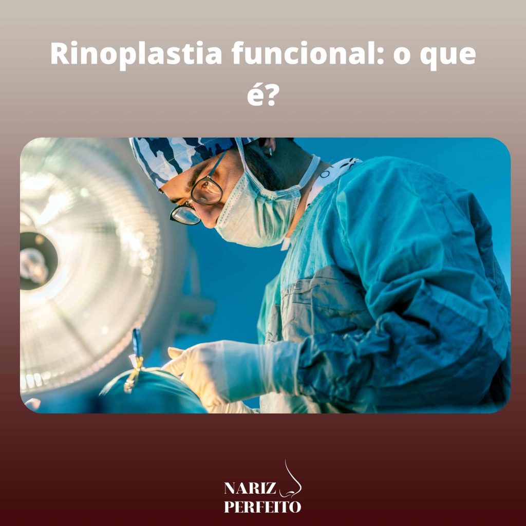 Rinoplastia funcional: o que é?