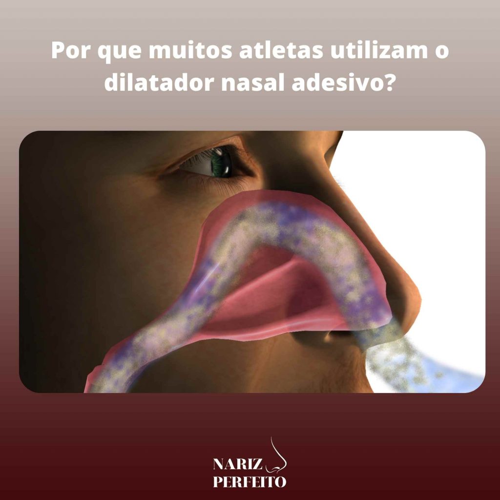 Por que muitos atletas utilizam o dilatador nasal adesivo?