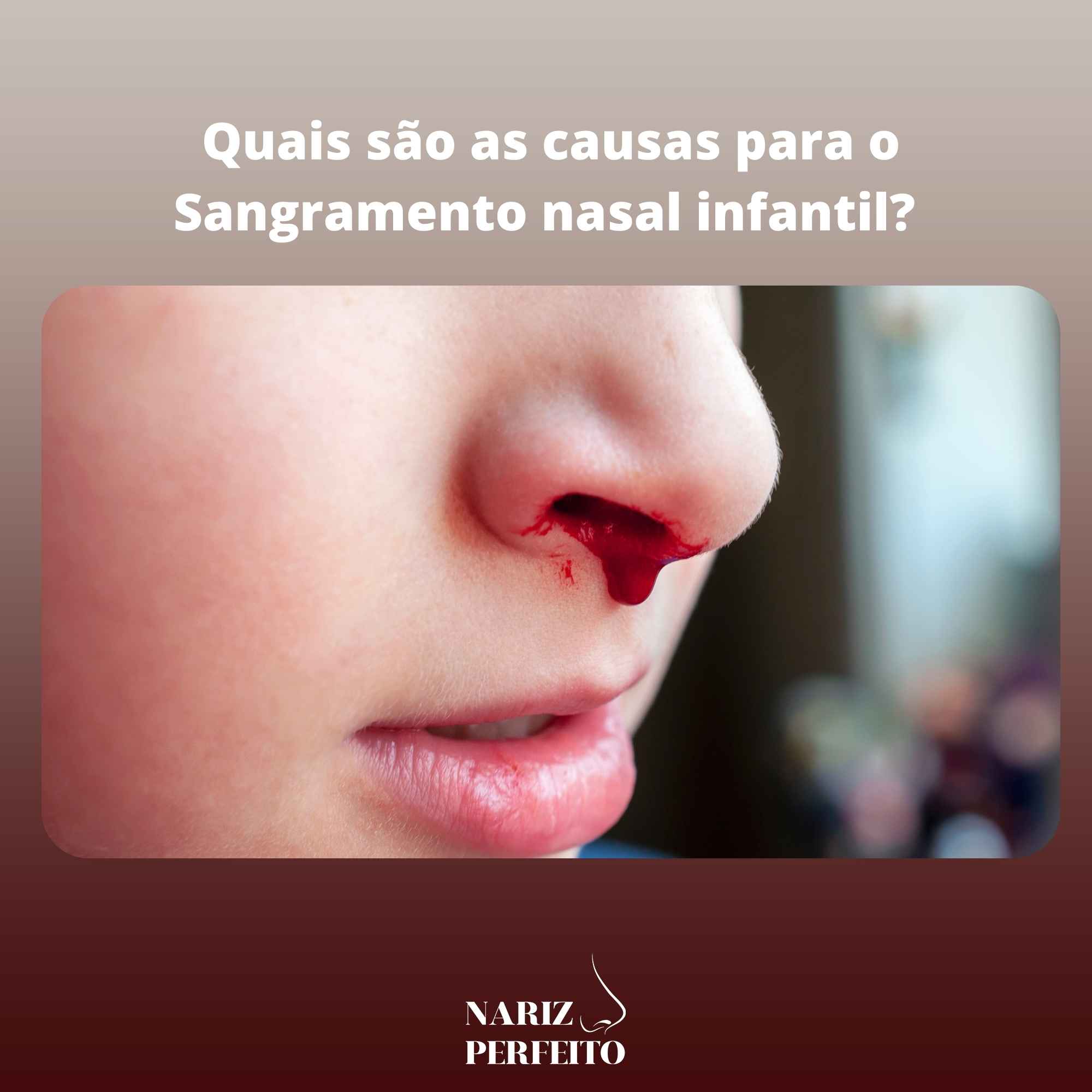 Sangramento Nasal: Entenda As Causas E Tratamentos – LPQVZF