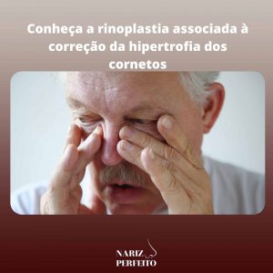 Conheça a rinoplastia associada à correção da hipertrofia dos cornetos