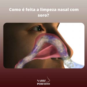 Como é feita a limpeza nasal com soro
