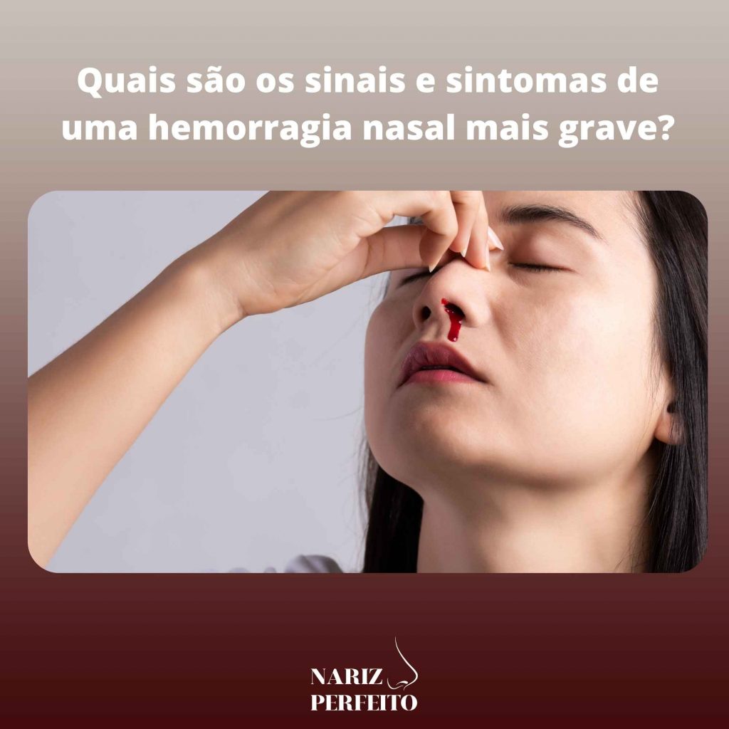 Quais são os sinais e sintomas de uma hemorragia nasal mais grave