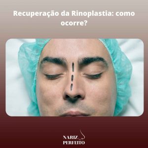 Recuperação da Rinoplastia: como ocorre?