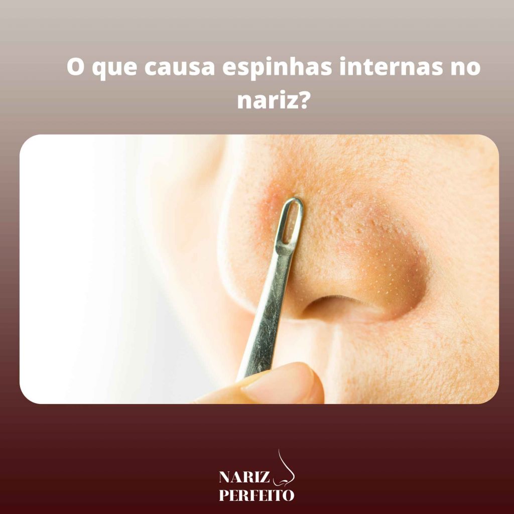 O que causa espinhas internas no nariz?