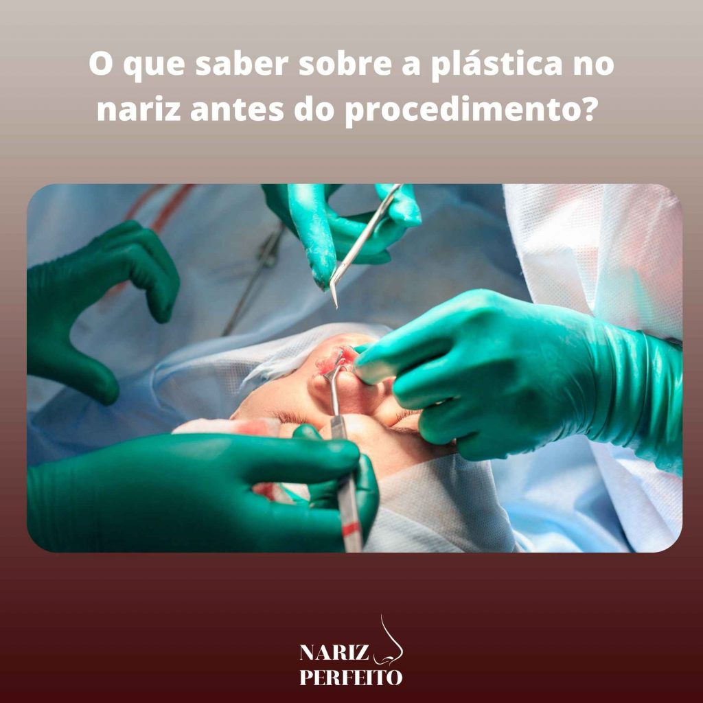 O que saber sobre a plástica no nariz antes do procedimento? 