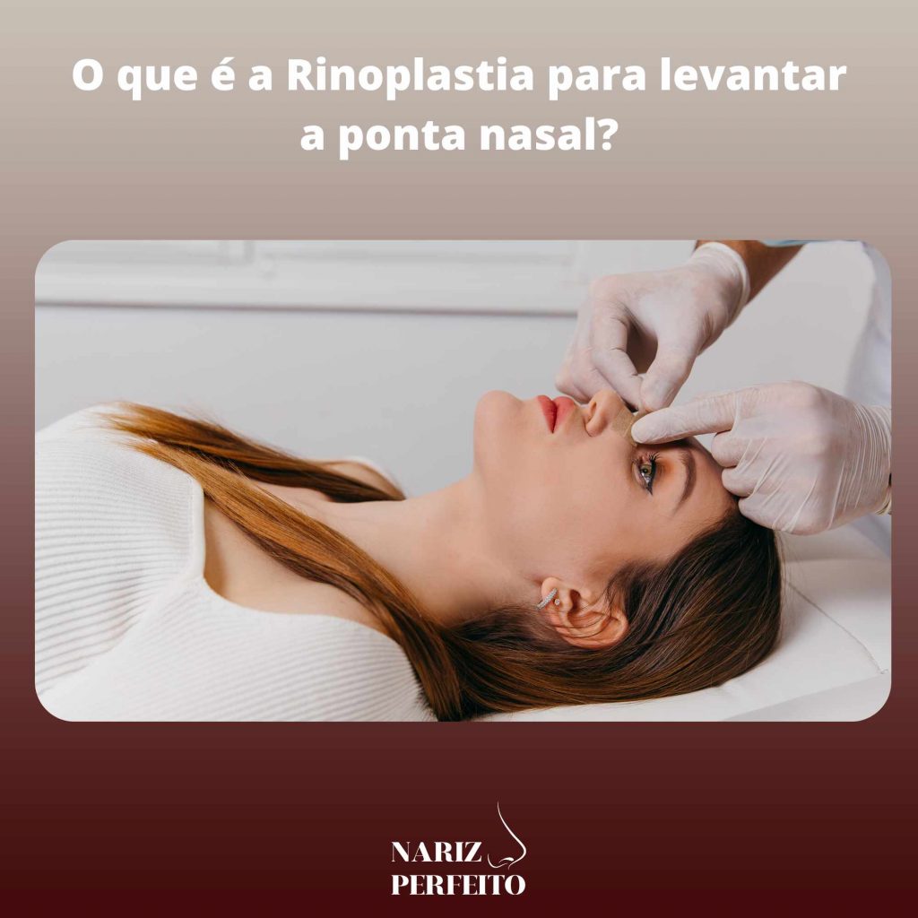 O que é a Rinoplastia para levantar a ponta nasal?