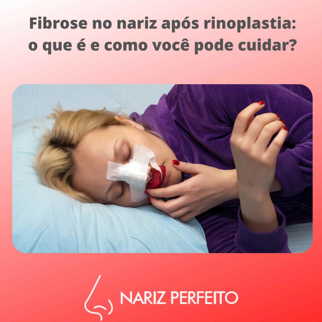 Fibrose no nariz após rinoplastia