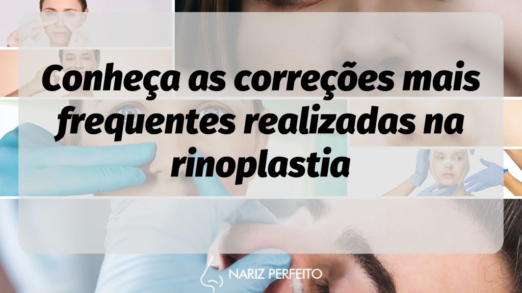 Conheça as correções mais frequentes realizadas na rinoplastia