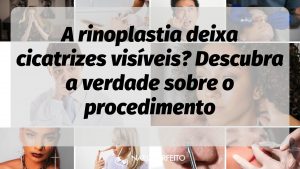 A rinoplastia deixa cicatrizes visíveis? Descubra a verdade sobre o procedimento