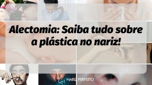 Alectomia: Saiba tudo sobre a plástica no nariz!