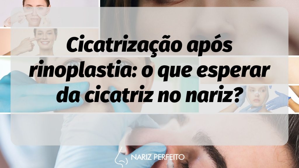 Cicatrização após rinoplastia: o que esperar da cicatriz no nariz?
