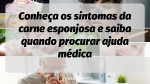 Conheça os sintomas da carne esponjosa e saiba quando procurar ajuda médica