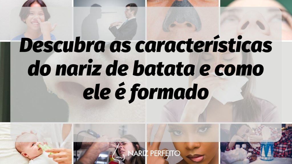 Descubra as características do nariz de batata e como ele é formado