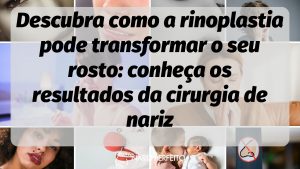 Descubra como a rinoplastia pode transformar o seu rosto: conheça os resultados da cirurgia de nariz