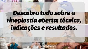 Descubra tudo sobre a rinoplastia aberta: técnica, indicações e resultados.