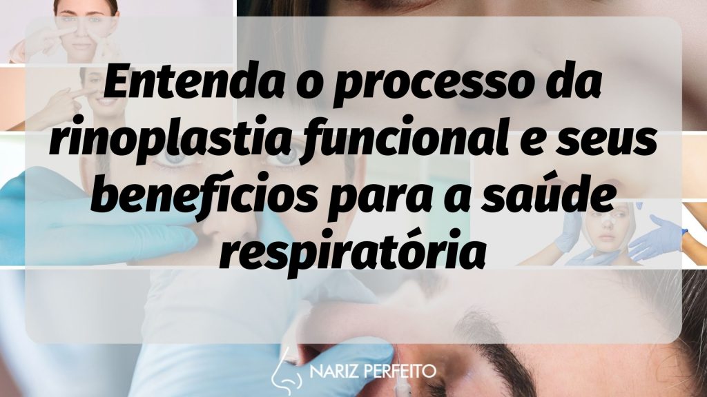 Entenda o processo da rinoplastia funcional e seus benefícios para a saúde respiratória