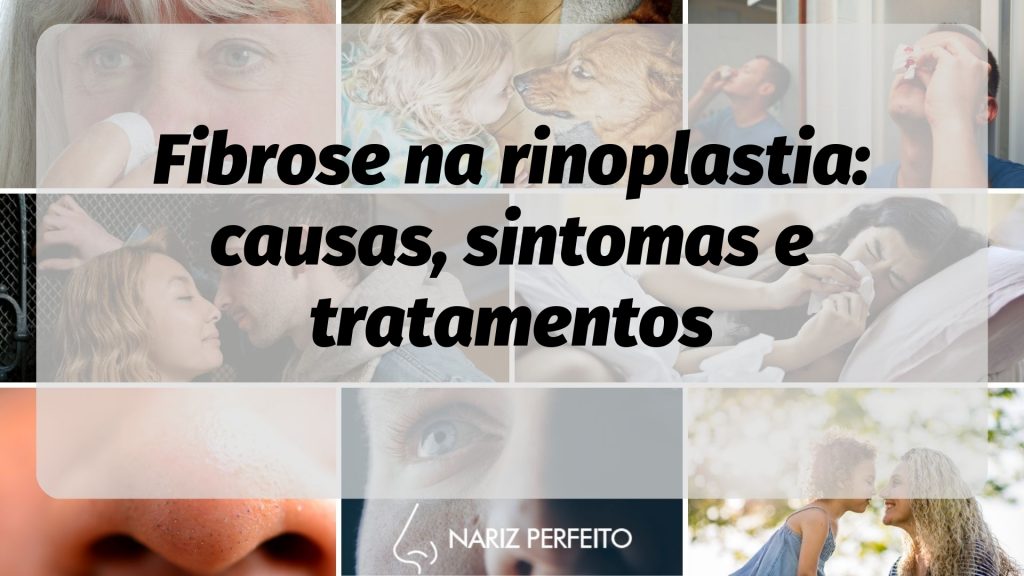 Fibrose na rinoplastia: causas, sintomas e tratamentos