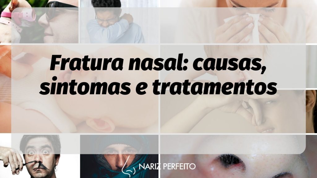 Fratura nasal: causas, sintomas e tratamentos