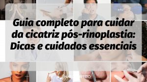 Guia completo para cuidar da cicatriz pós-rinoplastia: Dicas e cuidados essenciais