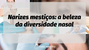Narizes mestiços: a beleza da diversidade nasal
