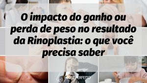 O impacto do ganho ou perda de peso no resultado da Rinoplastia: o que você precisa saber
