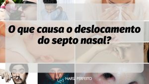 O que causa o deslocamento do septo nasal?