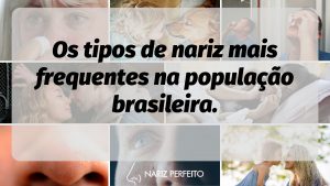 Os tipos de nariz mais frequentes na população brasileira.