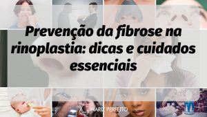 Prevenção da fibrose na rinoplastia: dicas e cuidados essenciais