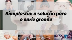 Rinoplastia: a solução para o nariz grande
