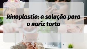 Rinoplastia: a solução para o nariz torto