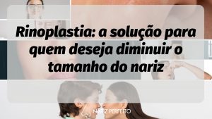 Rinoplastia: a solução para quem deseja diminuir o tamanho do nariz