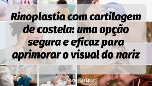 Rinoplastia com cartilagem de costela: uma opção segura e eficaz para aprimorar o visual do nariz