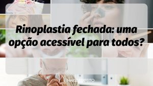 Rinoplastia fechada: uma opção acessível para todos?