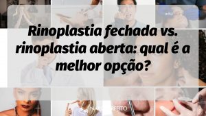 Rinoplastia fechada vs. rinoplastia aberta: qual é a melhor opção?