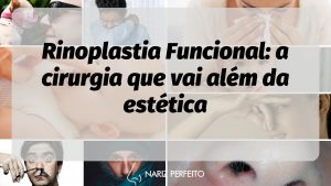 Rinoplastia Funcional: a cirurgia que vai além da estética