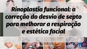 Rinoplastia funcional: a correção do desvio de septo para melhorar a respiração e estética facial