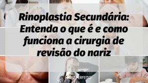 Rinoplastia Secundária: Entenda o que é e como funciona a cirurgia de revisão do nariz