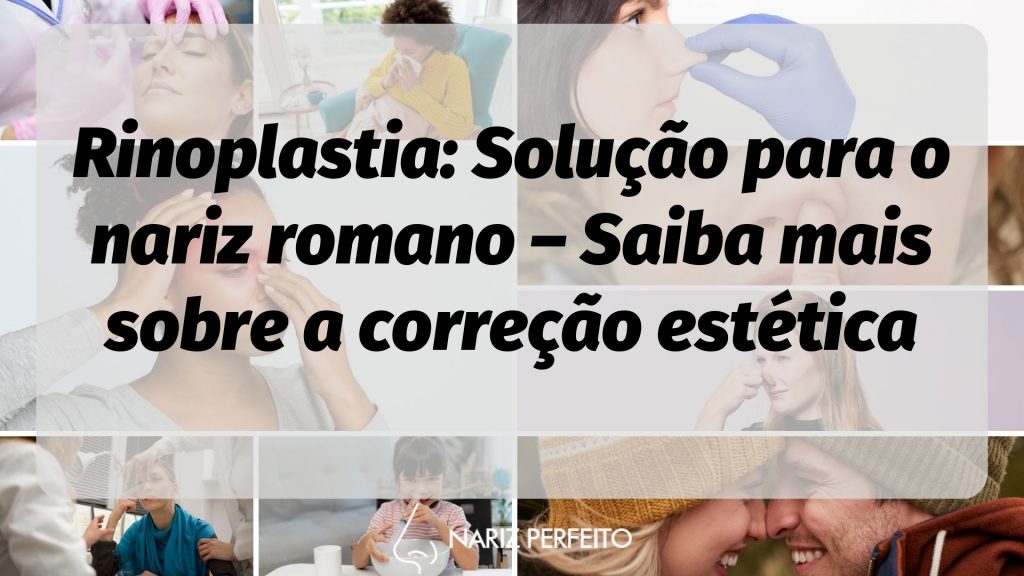 Rinoplastia: Solução para o nariz romano – Saiba mais sobre a correção estética