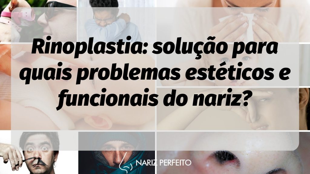 Rinoplastia: solução para quais problemas estéticos e funcionais do nariz?