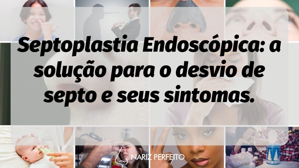 Septoplastia Endoscópica: a solução para o desvio de septo e seus sintomas.