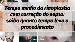 Tempo médio da rinoplastia com correção do septo: saiba quanto tempo leva o procedimento