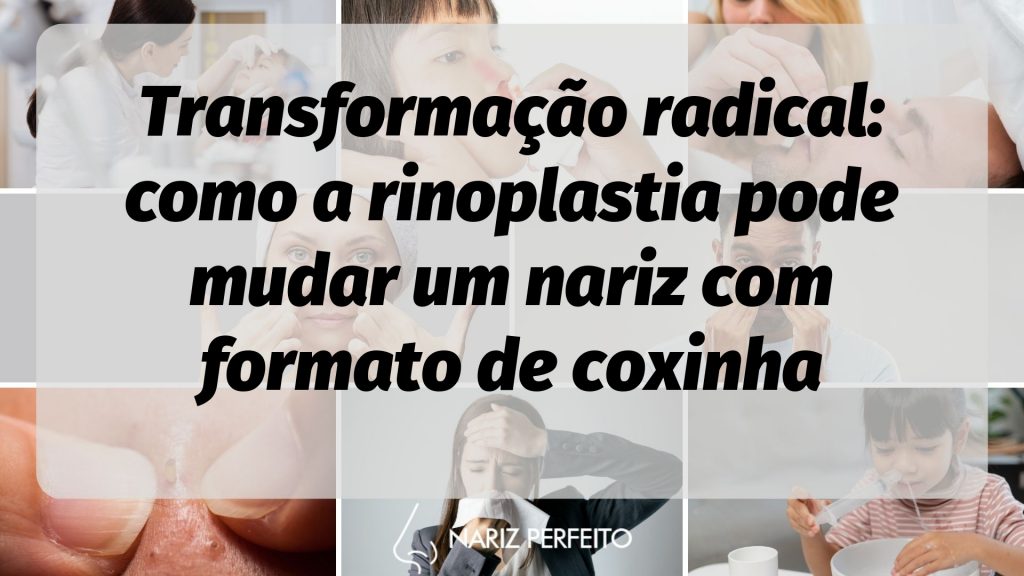 Transformação radical: como a rinoplastia pode mudar um nariz com formato de coxinha